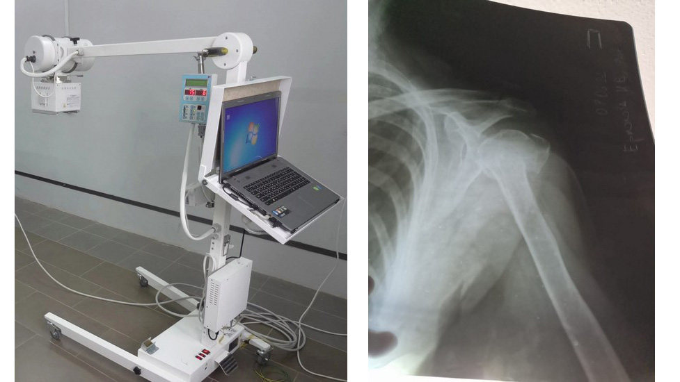 Рентген на дому Array
