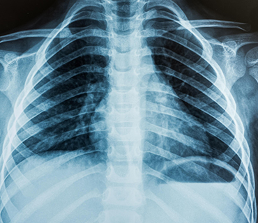 Перевозка лежачего больного на рентген и обратно в Москве в пределах МКАД